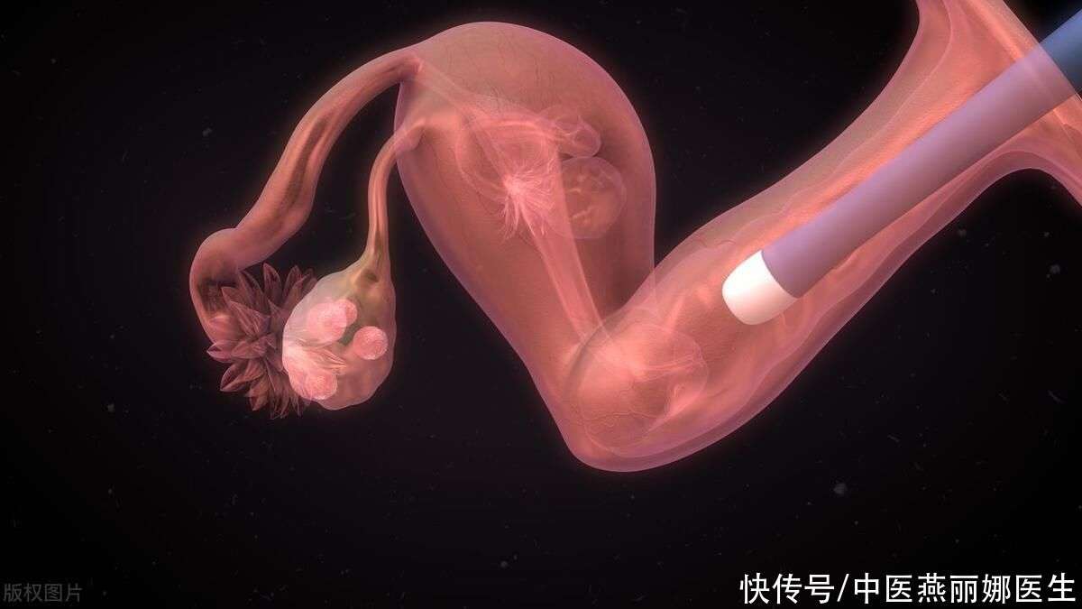 胎儿感知