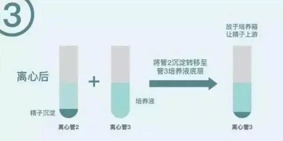 胎儿偏小