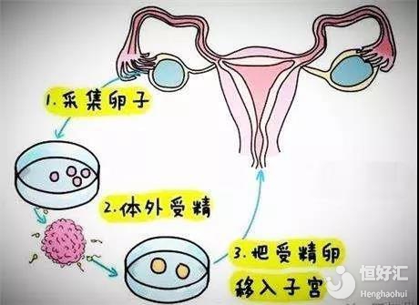 胎动计算器