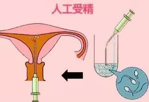 胚胎停育