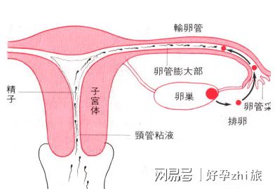 胖多囊综合症