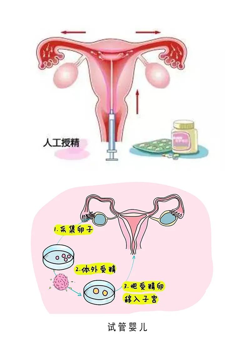 胚胎停育