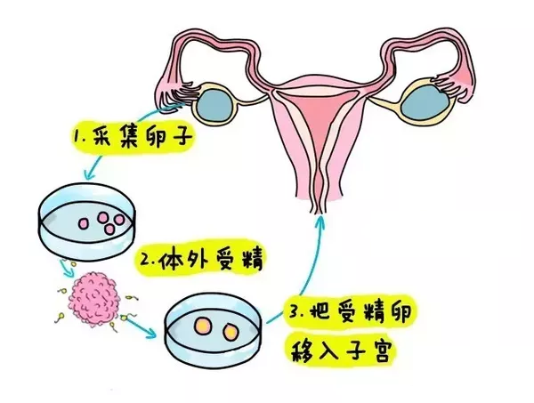 胚胎停育
