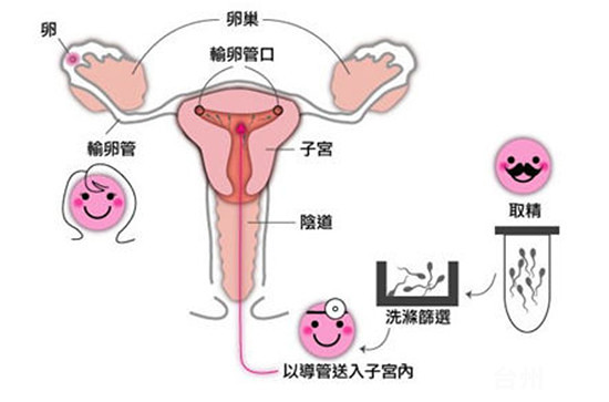 胚胎着床