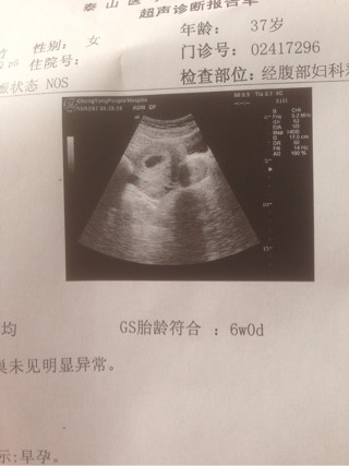 胚胎停止发育