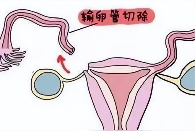 胚胎着床