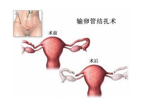 胚胎着床