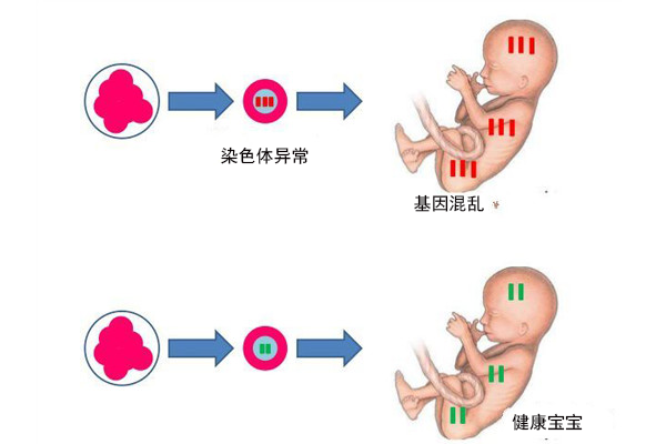 胚胎停育