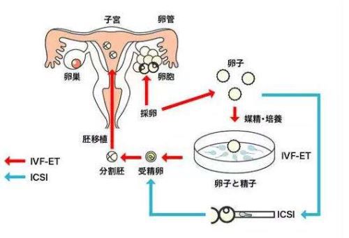 天津试管婴儿攻略
